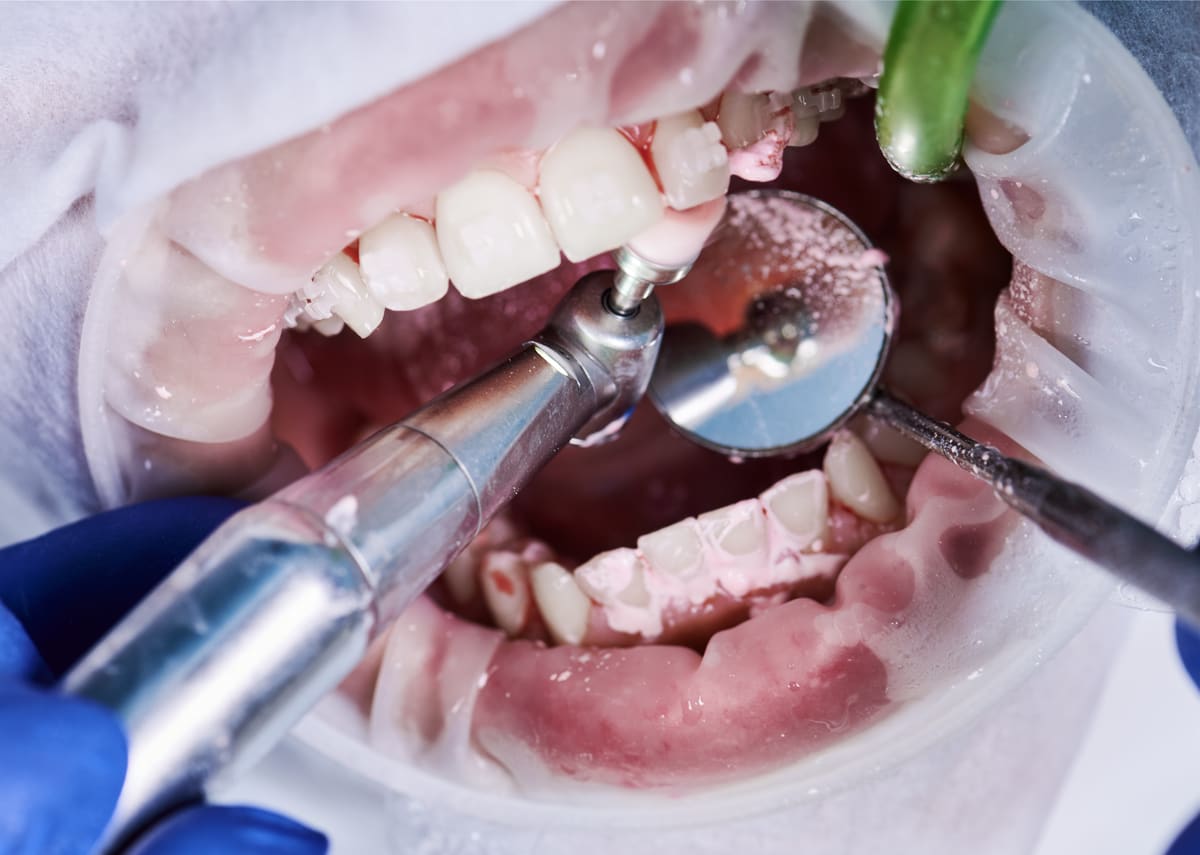 Cosmetic Dentistry